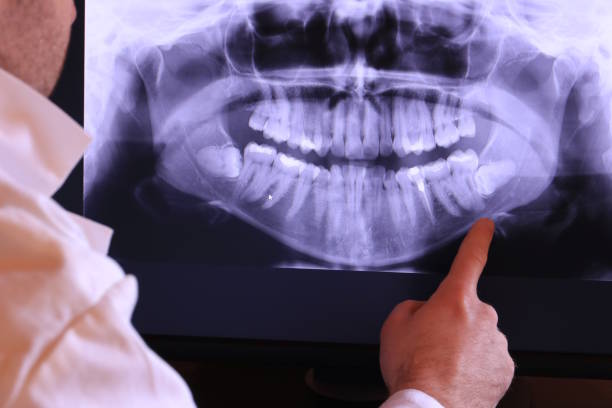 Best Dentist for Dental Trauma  in Bentleyville, PA